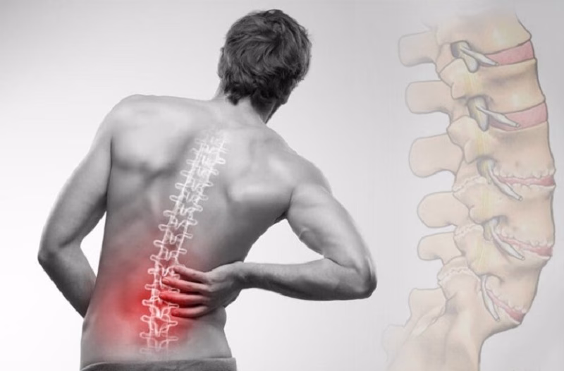 Đai kéo giãn cột sống lưng Yuminami 7 Người mắc bệnh lý cột sống